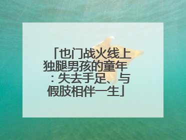也门战火线上独腿男孩的童年：失去手足、与假肢相伴一生